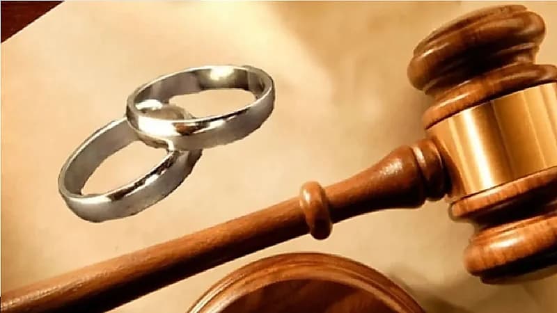 محامية : عمليات التجميل والتكميم قد تُجيز فسخ عقد النكاح