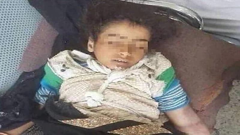 قصة الطفلة اليمنية أصيلة التي توفيت على يد والدها