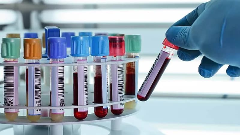 «النمر»‏: لا تعمل التحاليل إلا في مختبرات معتمدة