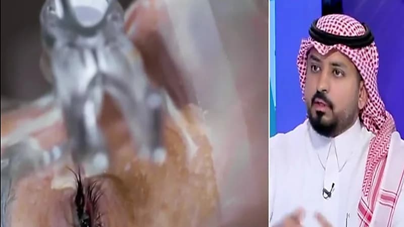 استشاري : التهابات العيون من العدسات اللاصقة وسوء استخدامها إحدى مسببات العمى (فيديو)