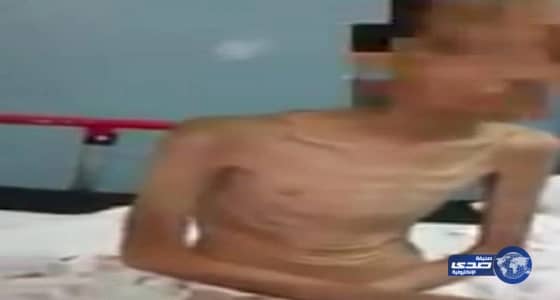 عم أطفال «معنفي خيبر»: أمهم أرادت تحويلهم لمعاقين للحصول على إعانة من الضمان الاجتماعي