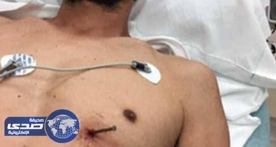 " قرار صعب " أنقذ حياة أمريكي استقر مسمار في قلبه