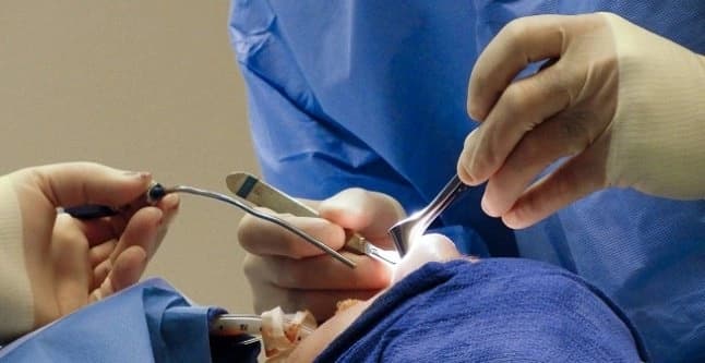 بالصورة ..حقيقة خضوع نجم تركى شهير لعملية تجميل بالأنف