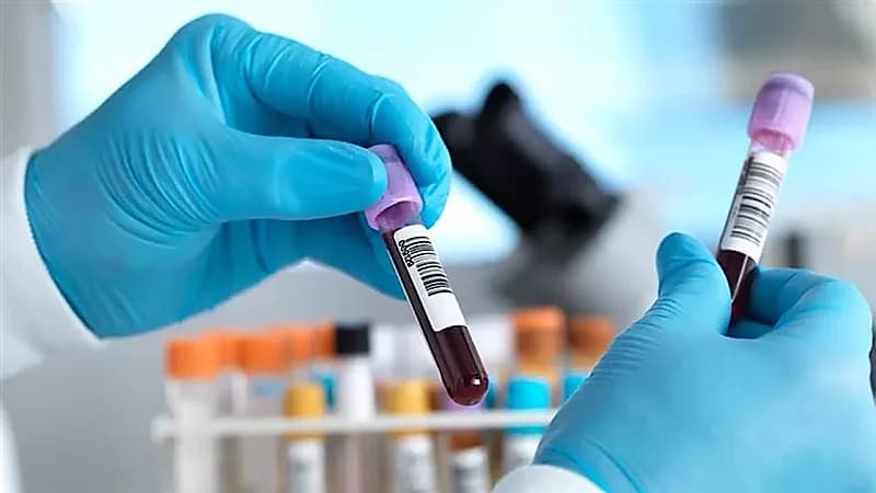 روسيا توفر لقاح السرطان مجاناً للمرضي بحلول 2025