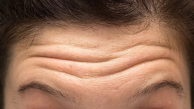 نصائح للتخلص من تجاعيد الجبهة